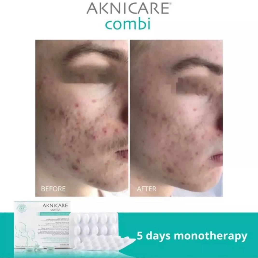 AK Combi 30 Tablets - Image 4