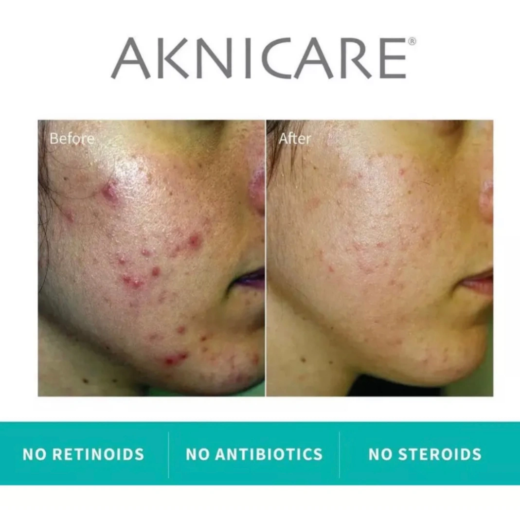 AK Combi 30 Tablets - Image 3