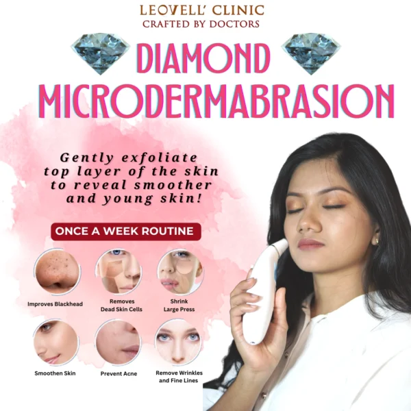 Microdermabrasion